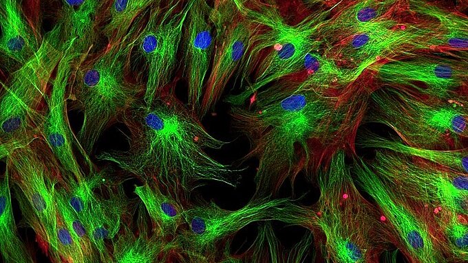 Positioning Solutions for Total Internal Reflection Fluorescence Microscopy